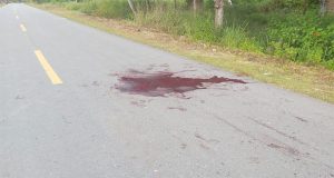 Polisi Kejar Pelaku Penganiayaan Berat Terhadap 2 Masyarakat di Kampung Bunyom, Kabupaten Jayapura