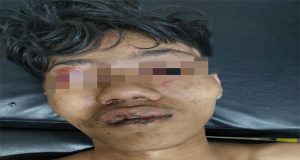 Main Hakim Sendiri , Berujung Kematian Seorang Pemuda Yang Harus Menghembuskan Nafas Terakhirnya