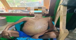 Butuh Penanganan Medis : Negara Harus Hadir Menolong Anak 12 Tahun Pengidap Penyakit Kanker Perut Di Pamijahan Kab Bogor