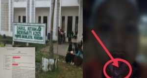 Santri SMP Pondok Pesantren Raudlatul Muhibbin Diduga Mengalami Kekerasan Pisik Oleh Seniornya, Keluarga Minta Pelaku Ditindak Tegas
